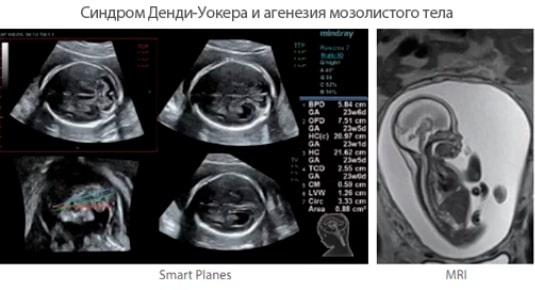 Smart Planes Smart Planes