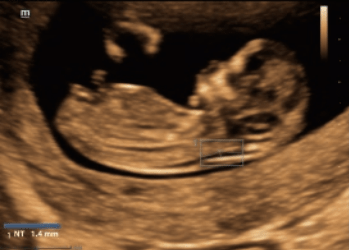 Smart OB/NT Smart OB/NT