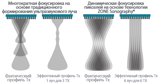 Динамическая фокусировка пикселей Динамическая фокусировка пикселей