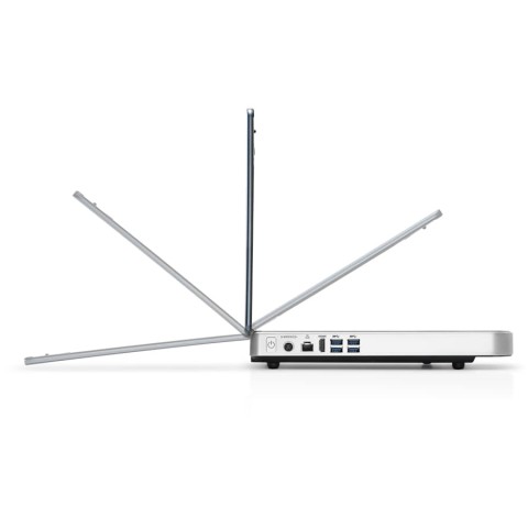 Портативный УЗИ аппарат Mindray Medical MX7