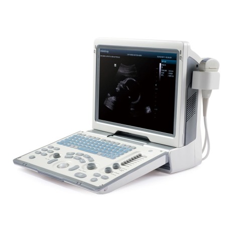 УЗИ аппарат Mindray DP-50 - 225 300 руб.